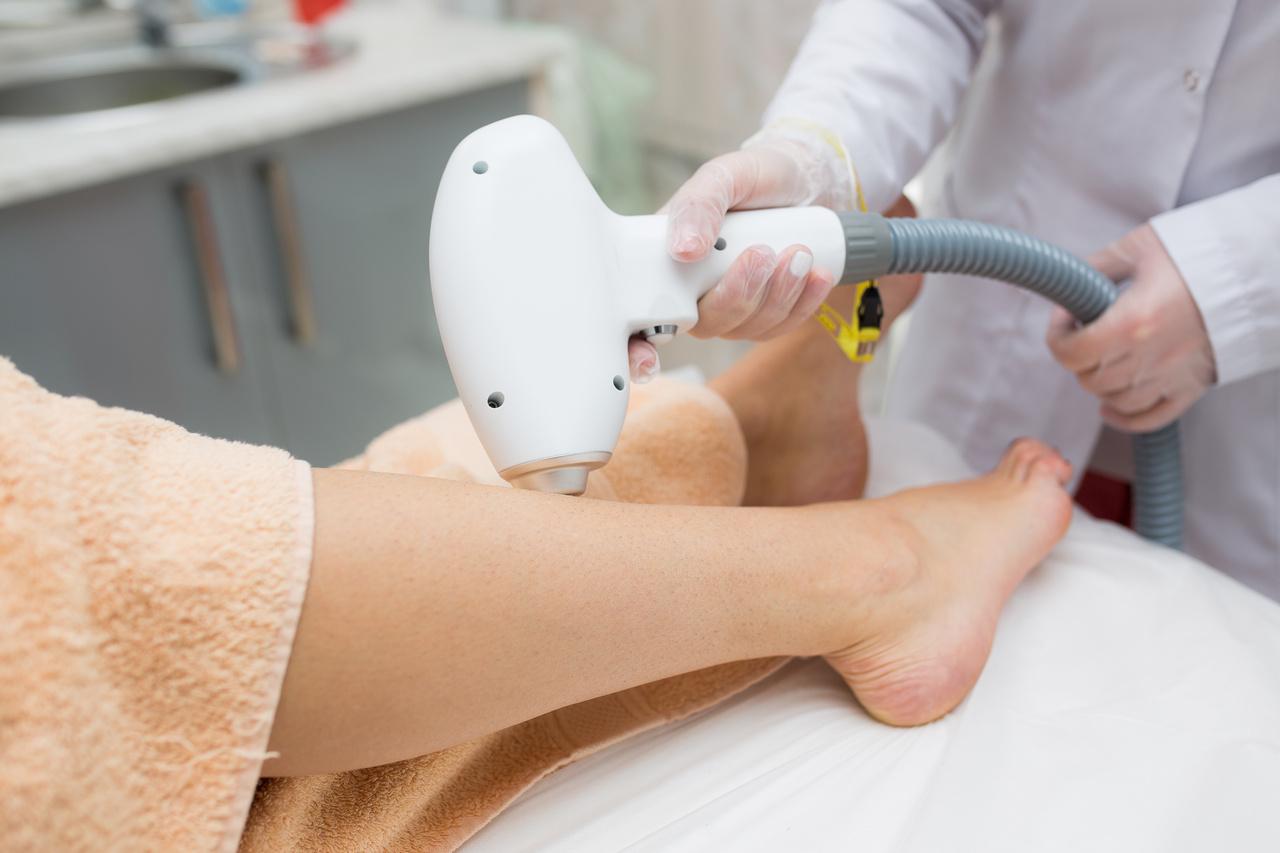 Depilação a laser na gravidez é segura?